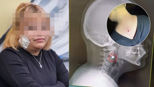 Francotiradores en Plaza España: hirieron a varios jóvenes desde un edificio