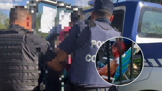 Perro ataca a un hombre y le provoca heridas de gravedad en el barrio de Villa Adela