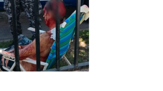 Perro ataca a un hombre y le provoca heridas de gravedad en el barrio de Villa Adela