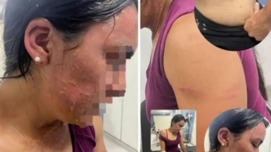 Ataque en Tucumán: le arrojaron agua hirviendo en un partido de hockey y piden detenciones