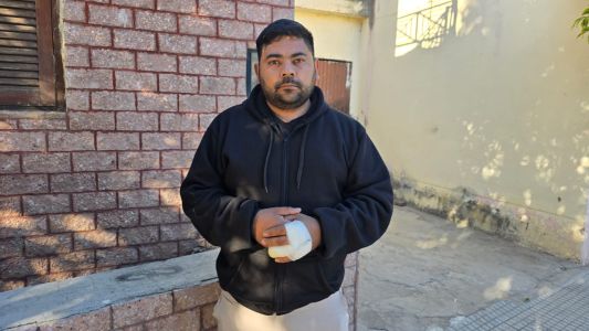 Violento asalto: le mordieron un dedo para robarle el celular