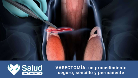 Vasectomía: mitos y verdades sobre uno de los métodos anticonceptivos más efectivos