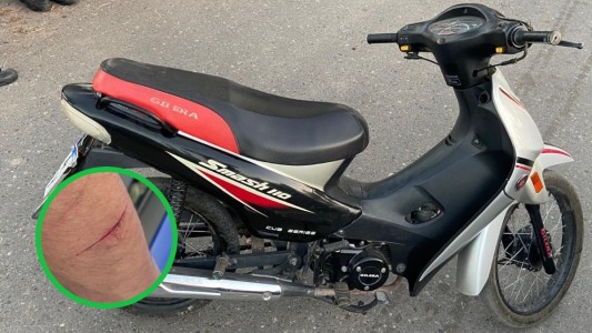 Violento operativo: dos detenidos y un policía herido tras una persecución