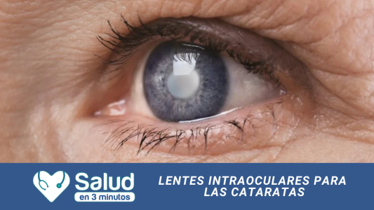 CATARATAS: Por qué se producen y cómo se tratan hoy con cirugía y lentes intraoculares