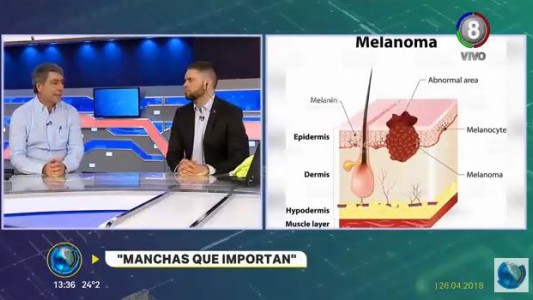 Cáncer de piel: ¿Se puede prevenir?