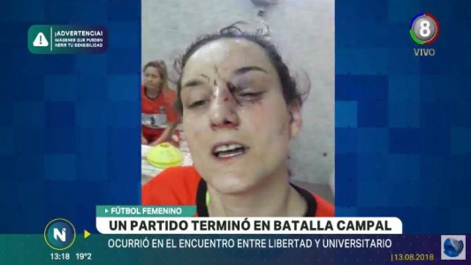 Fútbol femenino: Brutal golpiza entre jugadoras de Universitario y Libertad