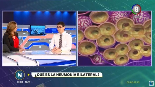 ¿Qué es la neumonía bilateral?