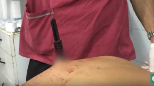 Ladrón apuñalado por dos mujeres en un asalto en Barrio Yofre Sur