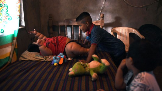 Obesidad y hambre, los dos grandes males de América Latina