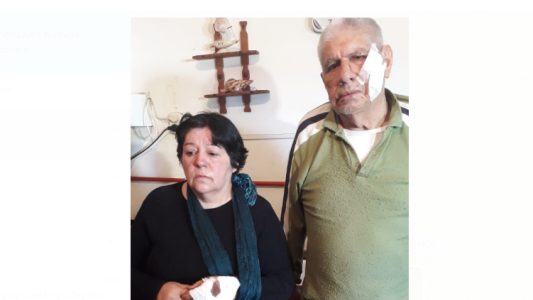 Malagueño: cuatro integrantes de una familia heridos por el ataque de un dogo