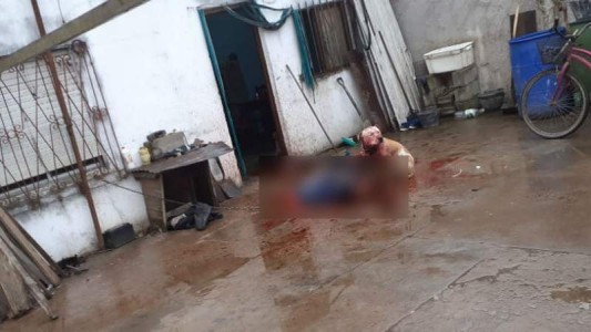 Murió un joven con síndrome de down al ser atacado por su perro pitbull