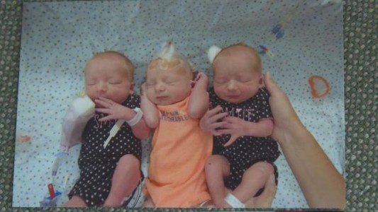 Fue al hospital por dolor de "cálculos": tuvo trillizos