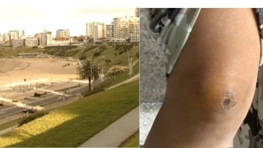 Mar del Plata: los mismos perros atacaron a otra mujer