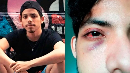 Una patota de encapuchados atacó a un joven por ser gay en Palermo