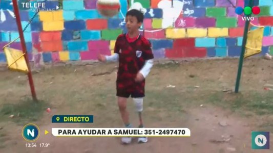 Tiene ocho años y necesita cambiar su pierna ortopédica