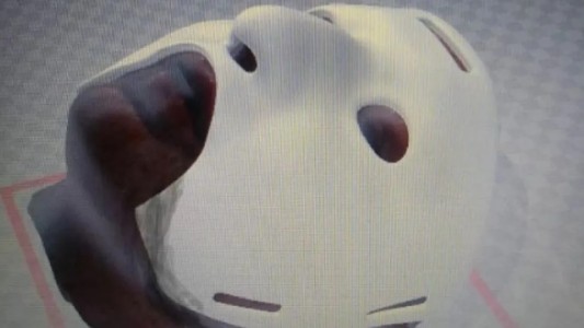 Cirujanos argentinos crearon una máscara 3D para reconstrucción facial