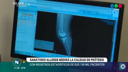 SALUD: La importancia de la trazabilidad y durabilidad de las prótesis