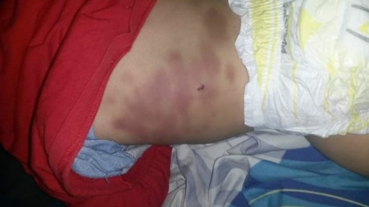 Imputan a la mamá de un bebé y a su pareja por golpearlo y fracturarle una costilla