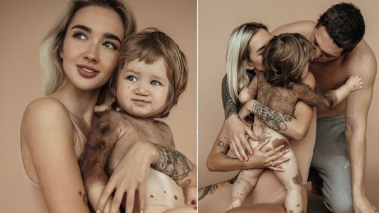 La influencer rusa que mostró en redes sociales la extraña enfermedad de su pequeño hijo