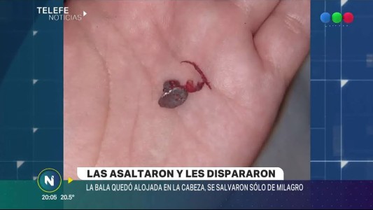 Recibió un tiro en la cabeza y sobrevivió "gracias a la capucha del buzo"
