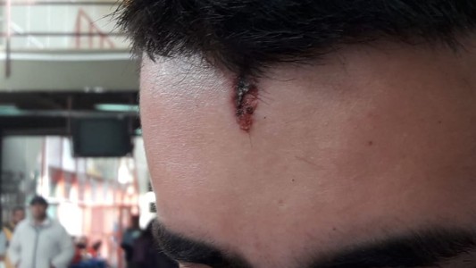 Habló el joven baleado en la frente: "Hoy la puedo contar"