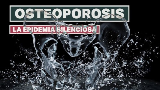 ¿Qué es la osteoporosis y cómo diagnosticarla?