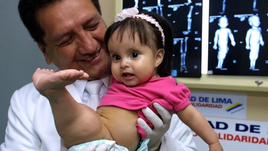 Murió la "nena sirena" de Perú