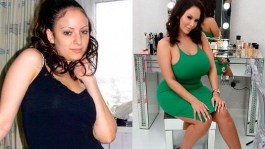 La mujer adicta a las cirugías estéticas que sueña con "la vagina de Barbie"