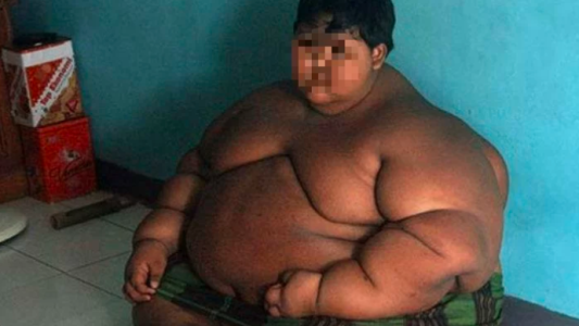 Video: el antes y después del nene que era considerado "el más obeso del mundo"