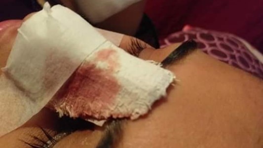 VIDEO: pelea en el Parque Sarmiento, dos mujeres recibieron una brutal golpiza