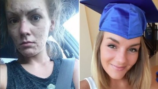 El antes y el después: mostró fotos a 2 años de empezar su recuperación de las drogas