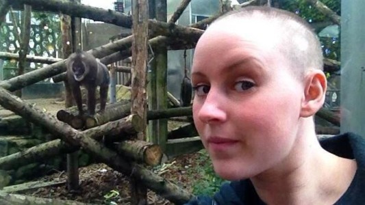 La historia de la joven que se quedó pelada por culpa del estrés