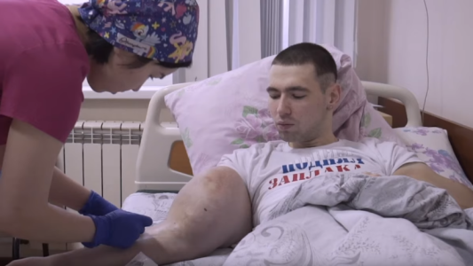 El Popeye ruso inició el camino para que sus brazos vuelvan a la normalidad