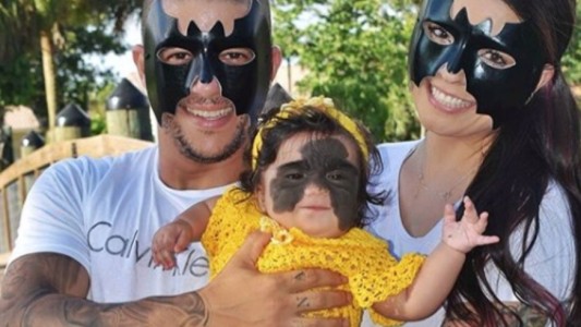 Operan a la beba con "máscara de Batman": su familia compartió las primeras imágenes