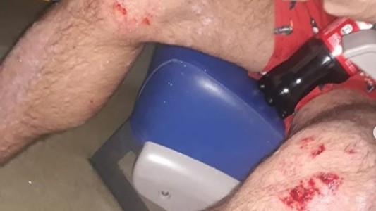 Buenos Aires: salvaje ataque homofóbico a una pareja en Villa Urquiza