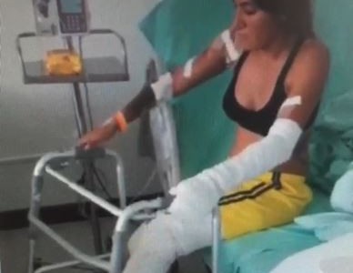 Turista argentina se quemó en Colombia: hacen colecta para su tratamiento médico