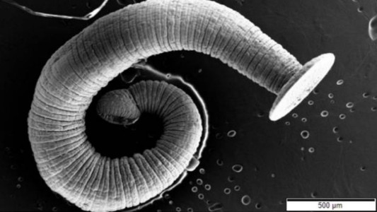 Un hombre tuvo durante 13 años un gusano de 12 centímetros en su cerebro