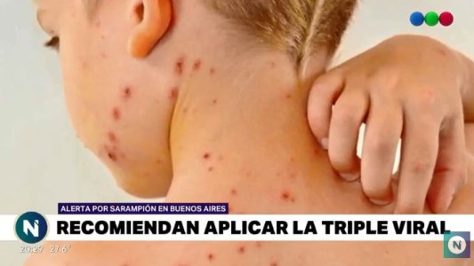 Turistas en alerta por casos de sarampión en Buenos Aires