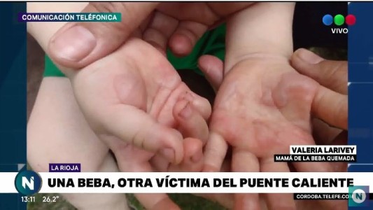 Habló la mamá de la nena quemada en el "puente caliente" de Carlos Paz
