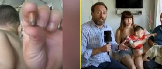 Un bebé fue herido con una bala perdida y los médicos le dijeron que un perro lo había mordido