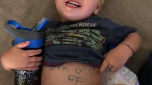 Indignante: escribieron con marcador la piel de un bebé para dejarle un mensaje a su mamá