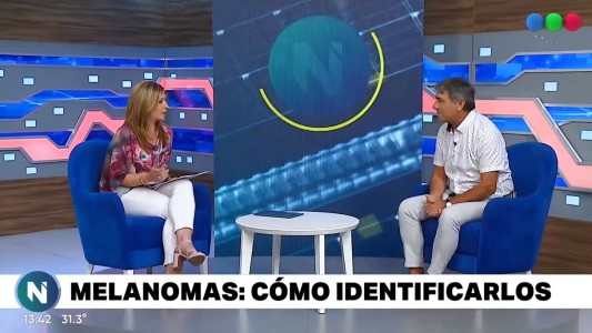 LUNARES PELIGROSOS: todo lo que hay que saber sobre la prevención del cáncer de piel o melanoma