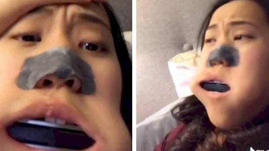 Hizo una broma, se metió una armónica en la boca y nunca pudo sacársela