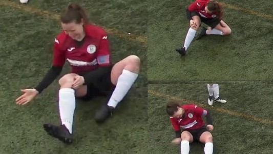 VIDEO: una futbolista escocesa se coloca la rodilla dislocada a golpes