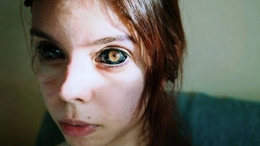 Una chica quiso imitar a un rapero, se tatuó los ojos de negro y quedó ciega