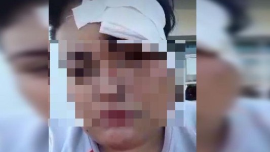 Ataque lesbofóbico: una mujer fue golpeada por 5 hombres por ser lesbiana
