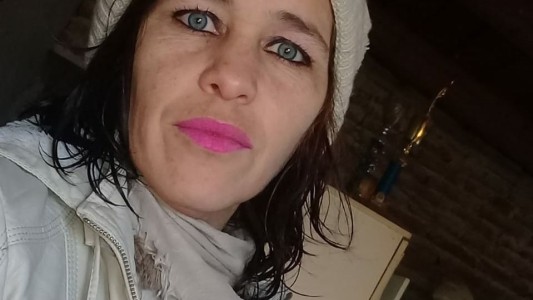 Murió la mujer que fue quemada por su pareja en La Plata