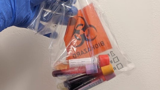 Cómo sería la cura al COVID-19 a partir de la primera paciente recuperada