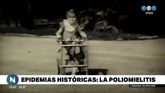 Epidemias históricas: Poliomelitis