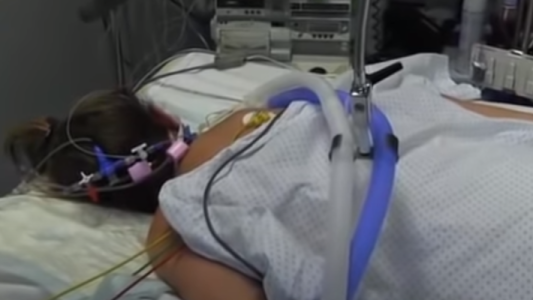 La razón por la cual los pacientes con coronavirus internados son acostados boca abajo